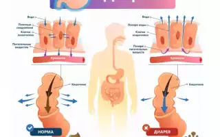 Виды поноса (диареи) у взрослых