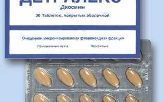 Сегментарный варикоз нижних конечностей
