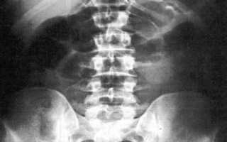 Рентген поджелудочной железы
