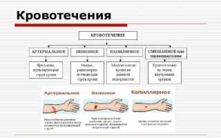 Какие виды кровотечений по анатомическому признаку