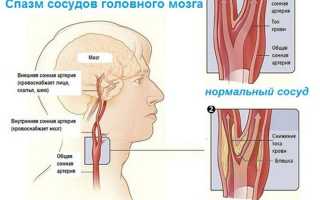 Судороги в голове причины